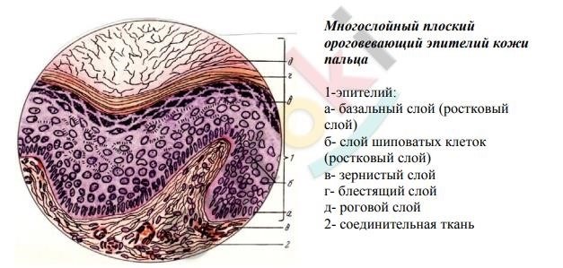 Итог